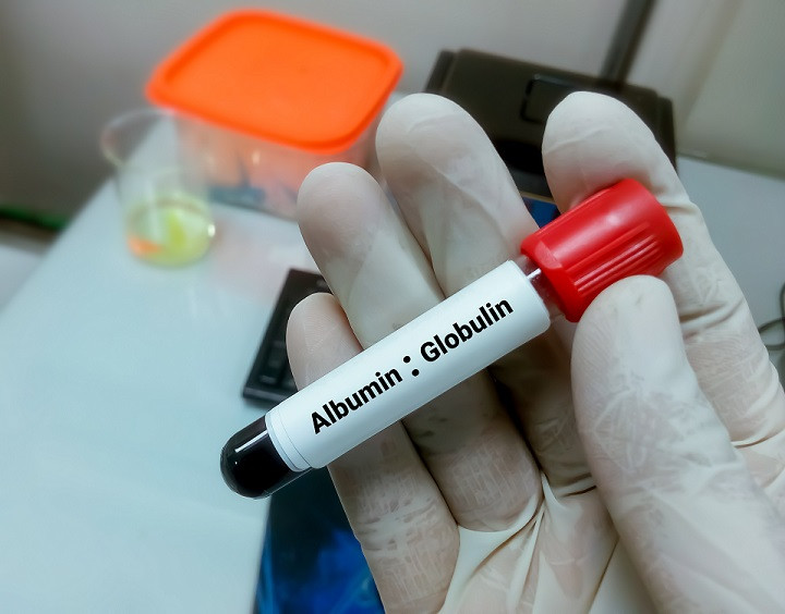 what-is-the-difference-between-albumin-and-globulin